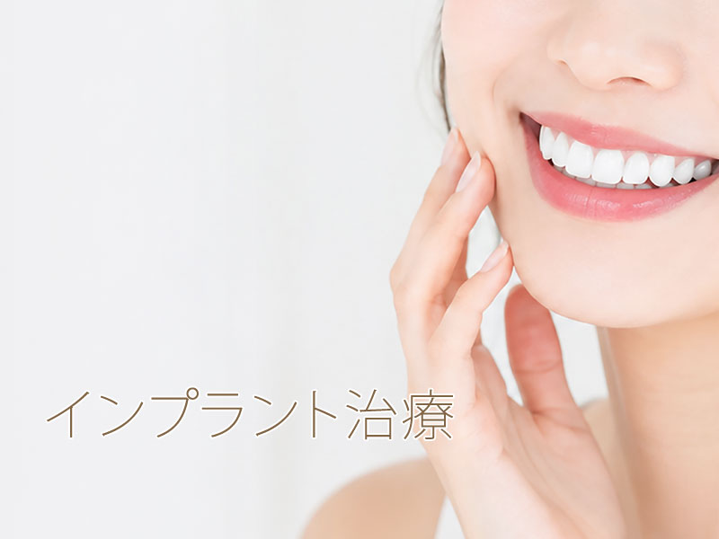 インプラント治療